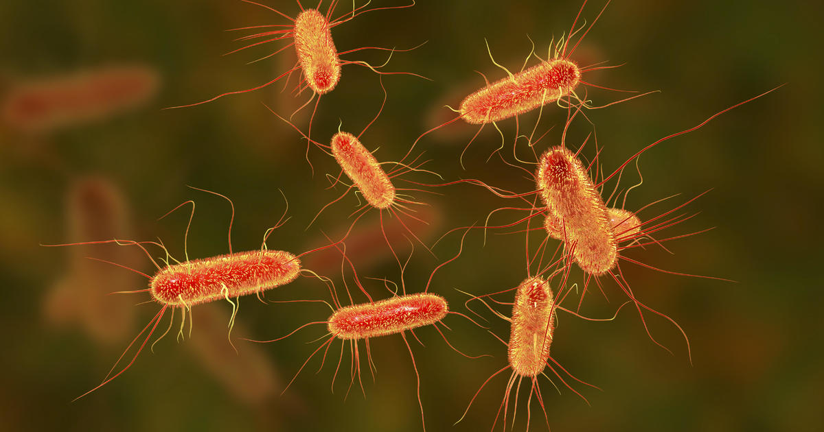 Fast Food Frenzy: Tracing the Source of the E. coli Outbreak